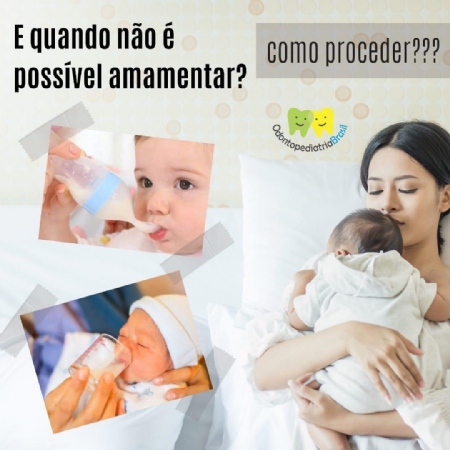 Aleitamento Materno – Odontopediatria Brasil